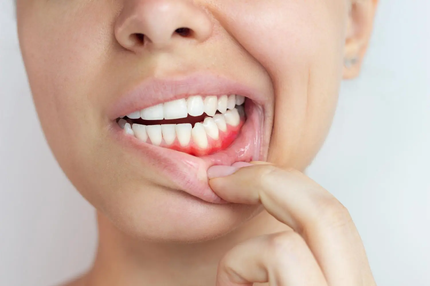 gum disease