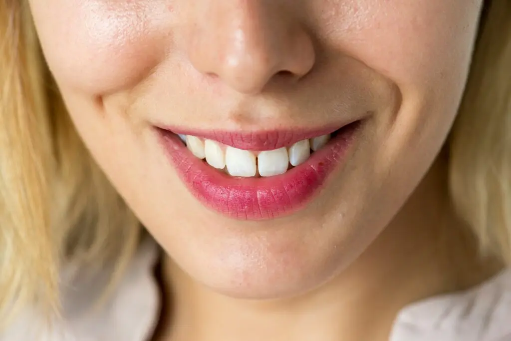 Gaps Between Teeth