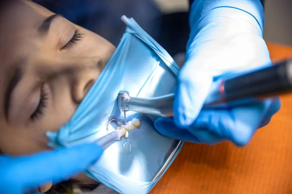 dental sealants