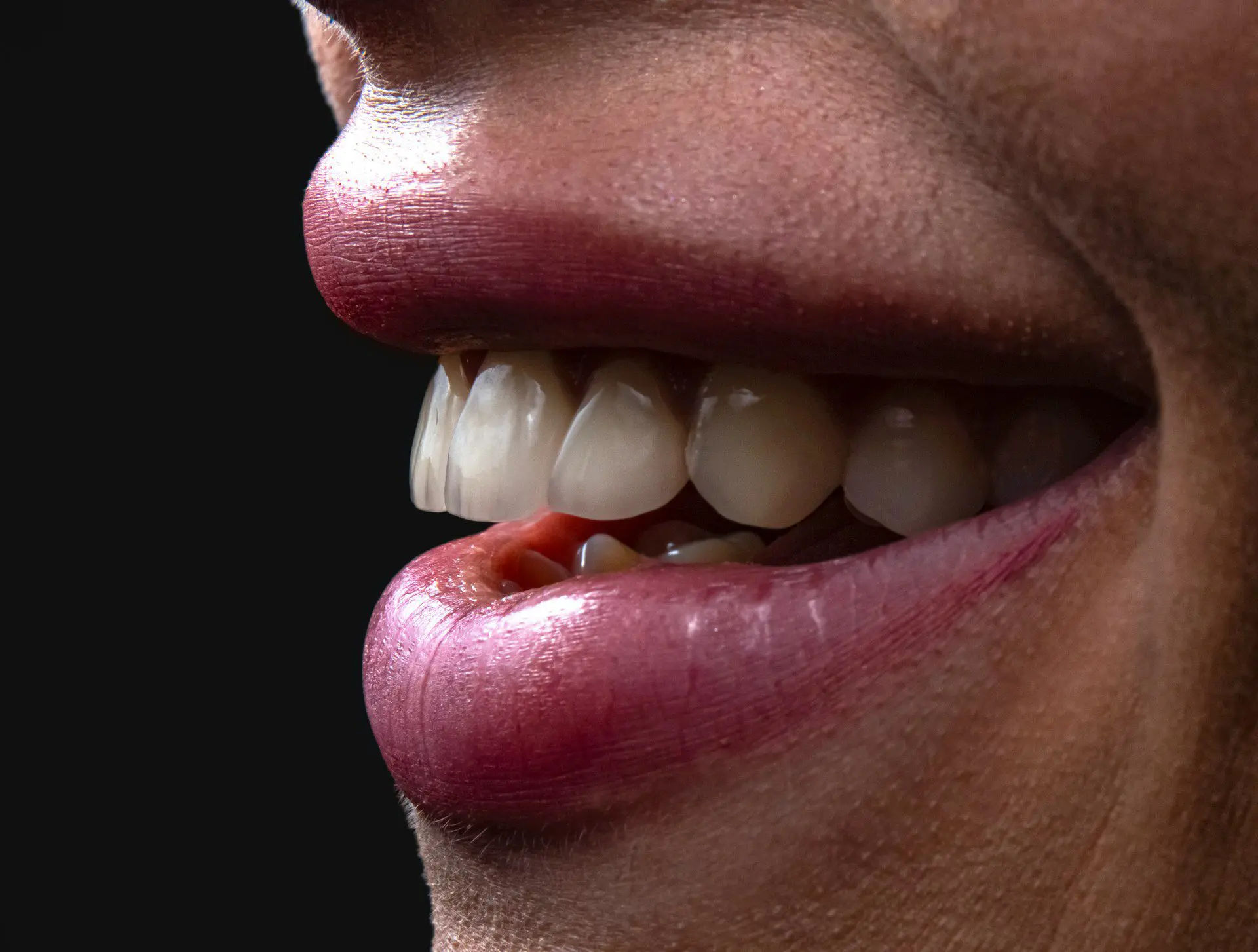overbites and underbites