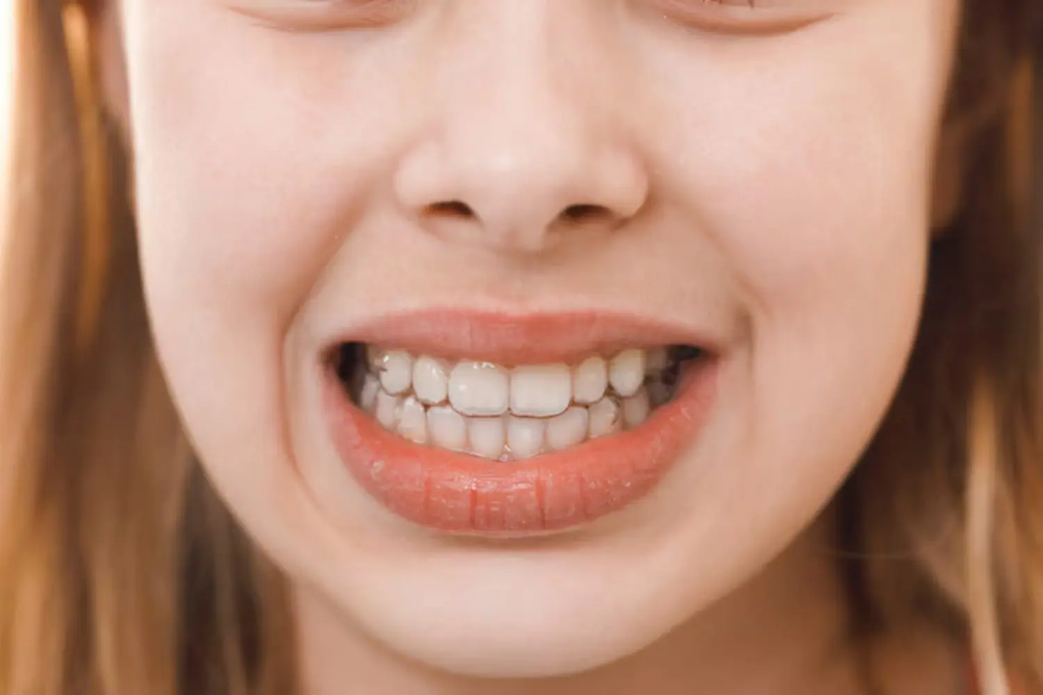 teeth staining