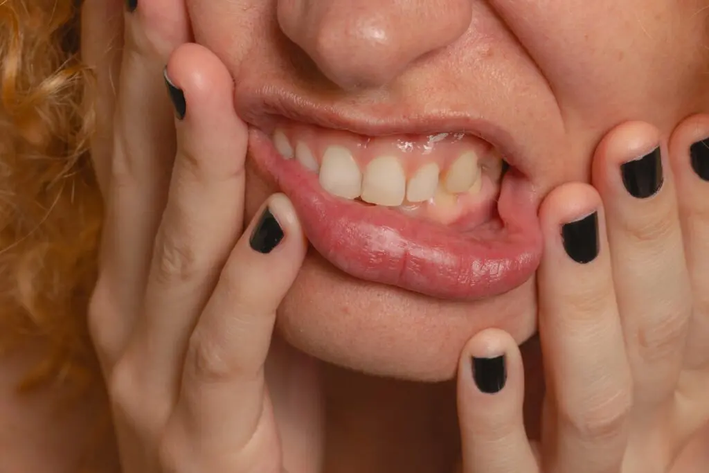 Gums Need Contouring