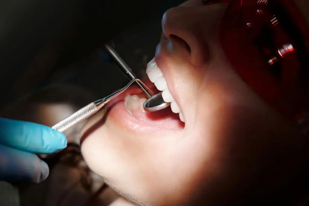teeth deep cleaning