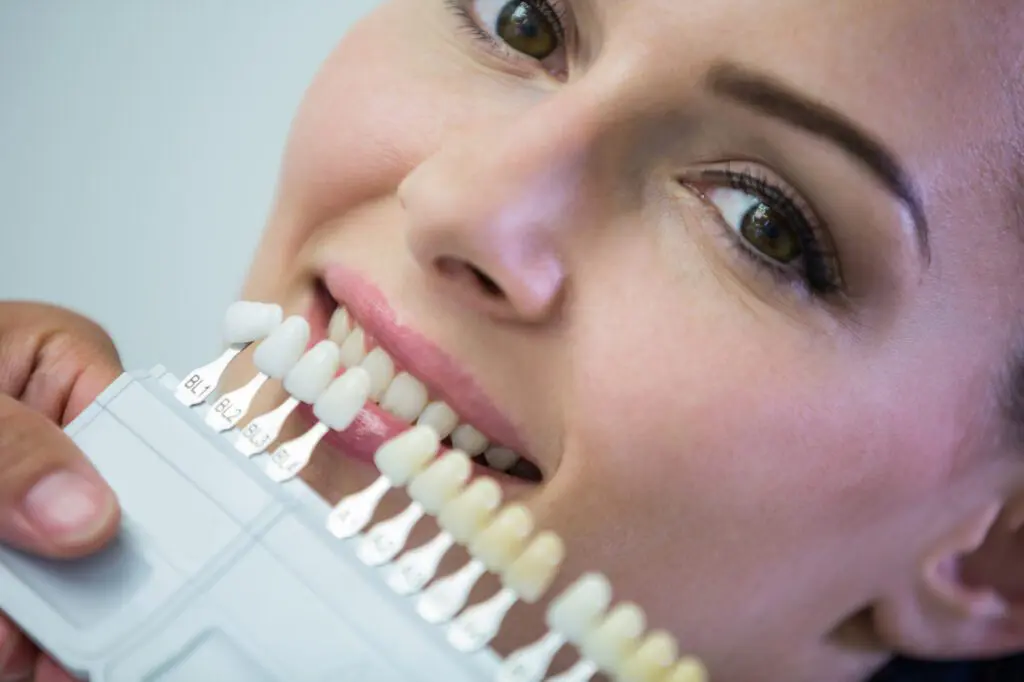 porcelain veneers