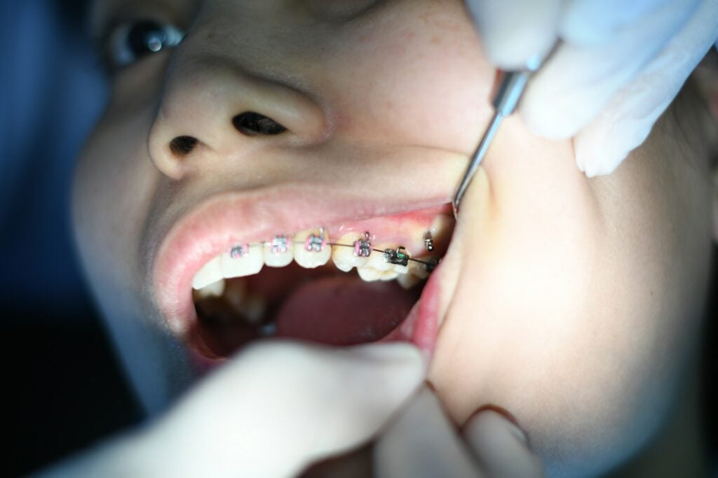 cosmetic dentistry
