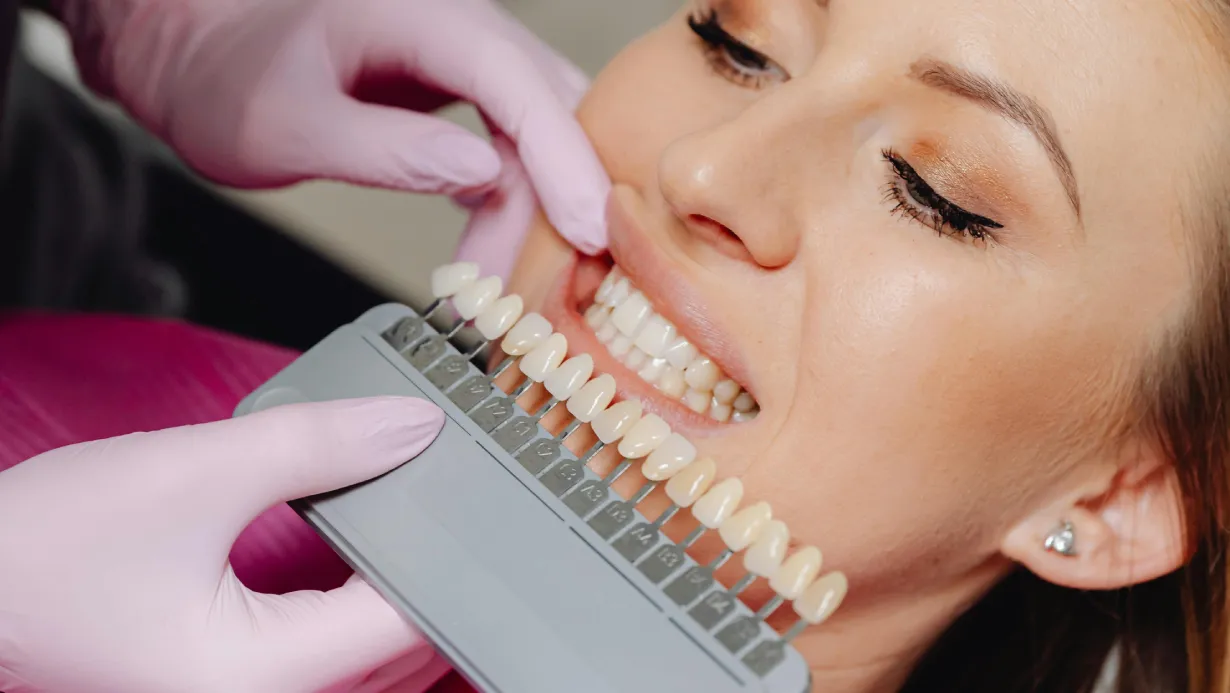 Teeth whitening